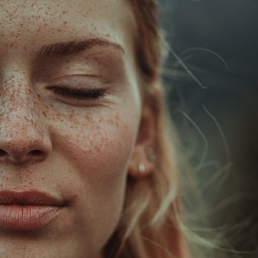Do you know what freckles are about?