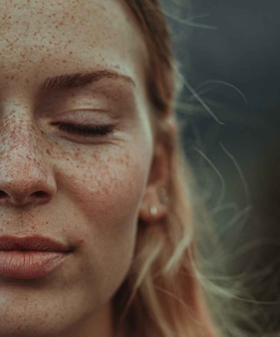 Do you know what freckles are about?
