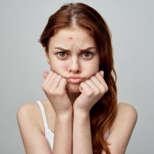 Acne map – check what pimples on different parts of the body can indicate