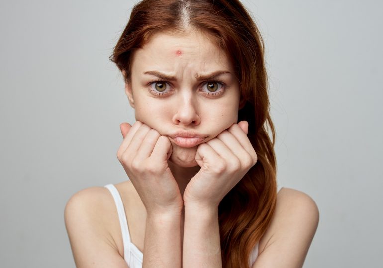 Acne map - check what pimples on different parts of the body can indicate