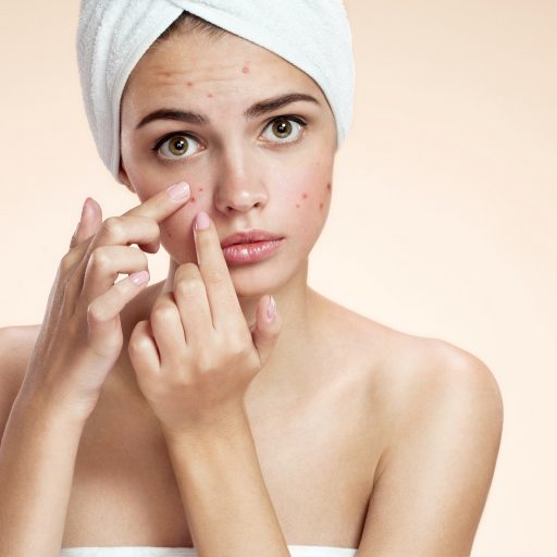 Everything you need to know about acne in adulthood