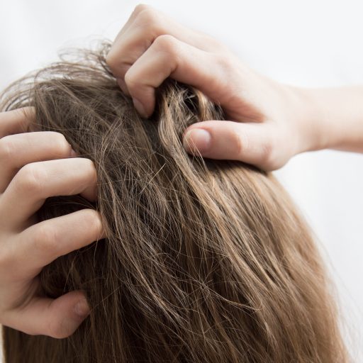 An itchy scalp – what could cause it and how do I combat the problem?