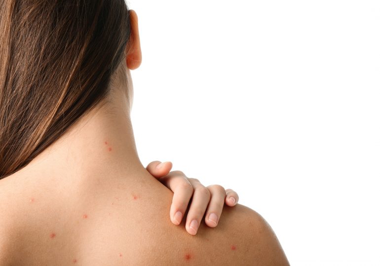 Acne on the back - why does it appear and how can you get rid of it?