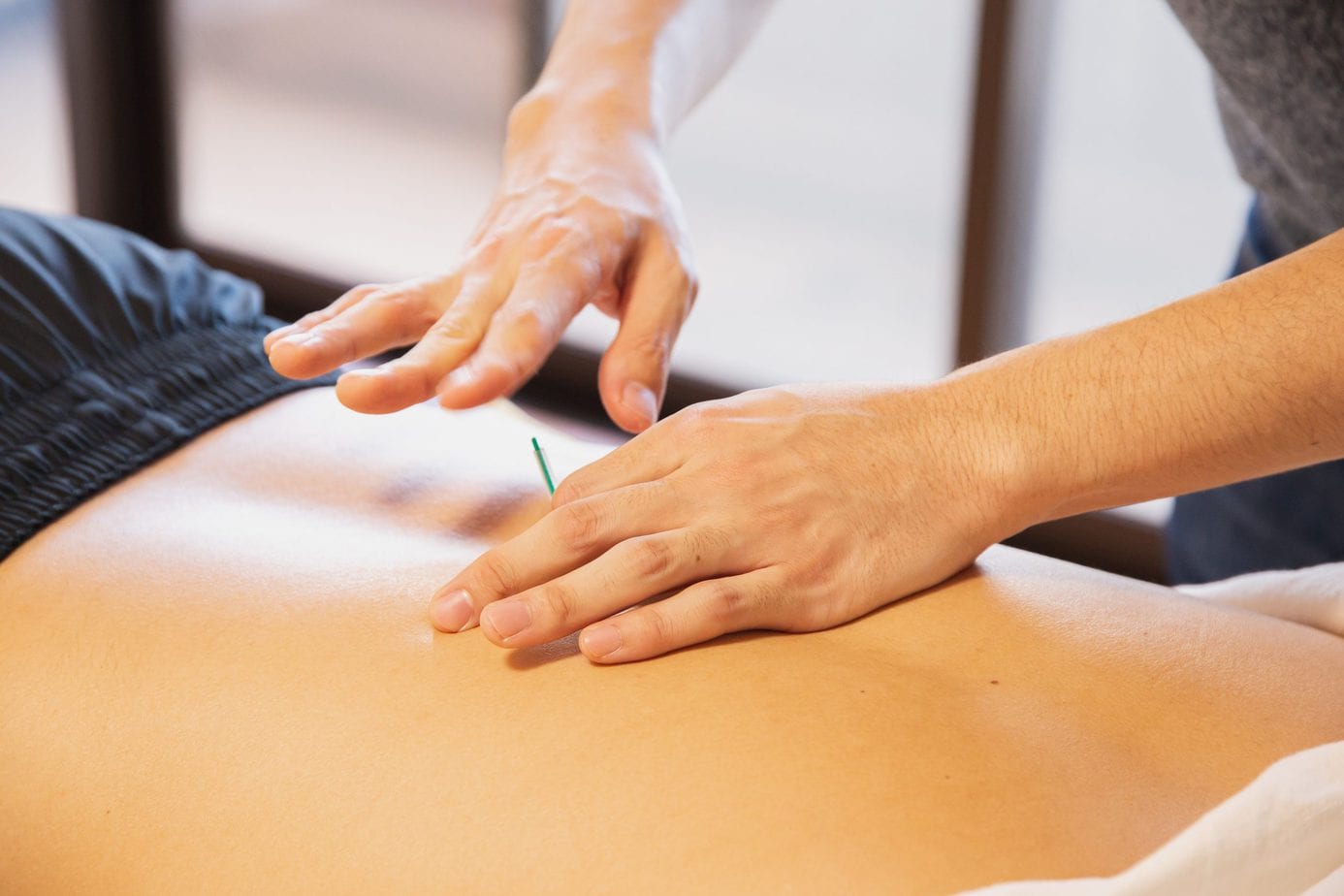 Acupuncture – what is it and why should you use it?